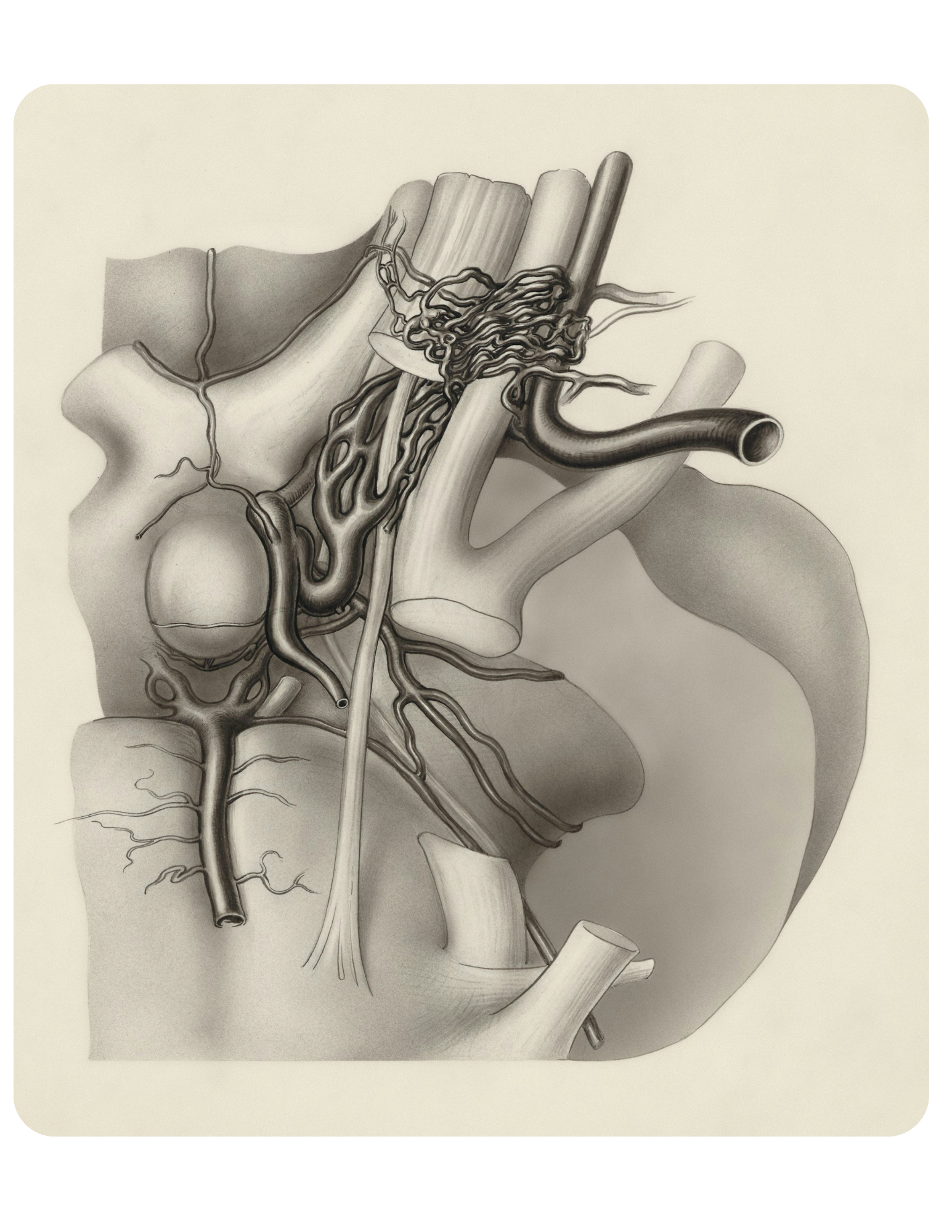 Anatomical illustration of the heart and surrounding blood vessels, from a cardiac emergency handled by InHouse Physicians.